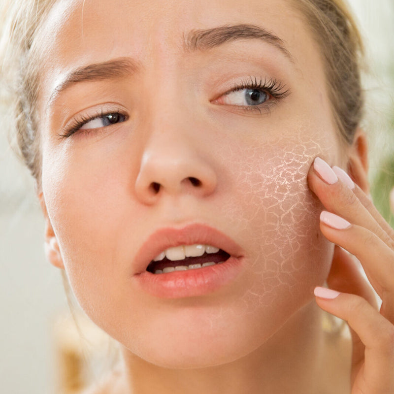 Droge huid - Skincare